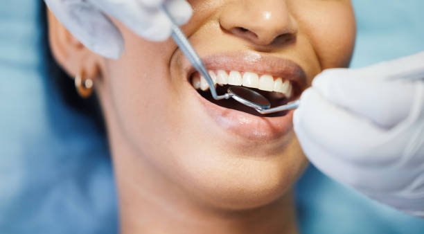 Urgent Tooth Repair in LA